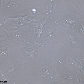 TSINGKE TC‒H0014 SNU-423 人肝癌细胞