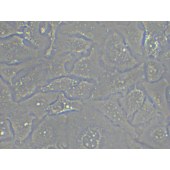 TSINGKE TC‒H0128 Kyse-520 人食管鳞癌细胞