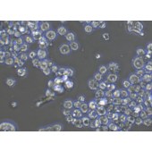 TSINGKE TC‒H0111 COLO 320DM 人结直肠腺癌细胞
