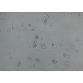 TSINGKE TC‒H0086 UACC812 人乳腺原导管瘤细胞