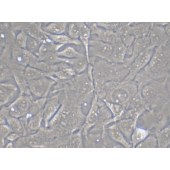 TSINGKE TC‒H0032 Calu-1 人肺癌细胞