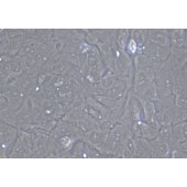 TSINGKE TC‒H0082 HCC38 人乳腺导管癌细胞