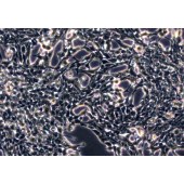 TSINGKE TC‒H0281 TT 人甲状腺导管癌细胞（髓样癌）