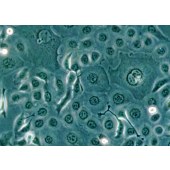 TSINGKE TC‒H0124 TE-1 人食管癌细胞