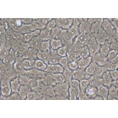 TSINGKE TC‒H0287 Bxpc-3 人原位胰腺癌细胞（中等至未分化）