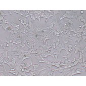 TSINGKE TC‒H0174 22Rv1 人前列腺癌细胞