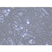 TSINGKE TC‒H0020 NCI-H292 人肺粘液上皮样癌细胞