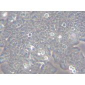 TSINGKE TC‒H0084 MDA-MB-361 人乳腺癌细胞