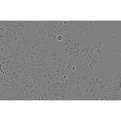TSINGKE TC‒H0283 Panc-1 人胰腺癌细胞（未分化）
