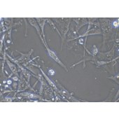 TSINGKE TC‒H0205 U-87 MG 人脑星形胶质母细胞瘤细胞