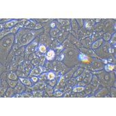 TSINGKE TC‒R0012 Renca 小鼠肾癌细胞