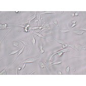 TSINGKE TC‒H0204 U-118 MG 人脑星形胶质母细胞瘤细胞