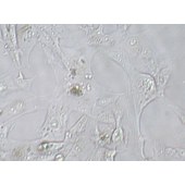 TSINGKE TC‒H0180 Caki-1 人肾透明细胞癌皮肤转移细胞