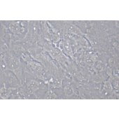 TSINGKE TC‒H0154 TCCSUP 人膀胱癌细胞