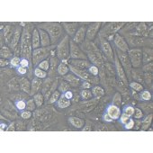 TSINGKE TC‒H0150 T24 人膀胱移行细胞癌细胞