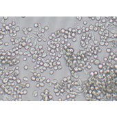 TSINGKE TC‒H0094 MKN45 人胃癌细胞