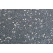 TSINGKE TC‒H0300 SV-HUC-1 人膀胱上皮永生化细胞