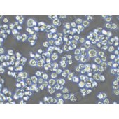 TSINGKE TC‒H0195 Namalwa 人Burkitt's淋巴瘤细胞