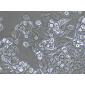 TSINGKE TC‒H0112 LS 174T 人结肠腺癌细胞