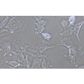 TSINGKE TC‒H0274 SW579 人甲状腺鳞癌细胞