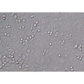 TSINGKE TC‒H0150 T24 人膀胱移行细胞癌细胞