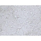 TSINGKE TC‒H0049 NCI-H2170 人肺鳞癌细胞