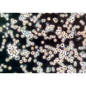 TSINGKE TC‒H0192 Raji 黑人Burkitt淋巴瘤细胞