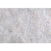 TSINGKE TC‒H0270 SK-N-MC 人神经上皮瘤细胞