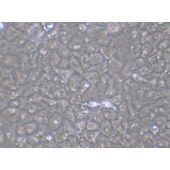 TSINGKE TC‒H0131 Cal-27 人舌鳞癌细胞