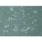 TSINGKE TC‒H0089 HCC1954 人乳腺导管癌细胞