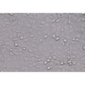 TSINGKE TC‒H0066 MDA-MB-231 人乳腺癌细胞