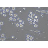 TSINGKE TC‒H0220 SK-MEL-1 人皮肤黑色素瘤细胞