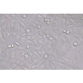 TSINGKE TC‒H0257 143B 人骨肉瘤细胞