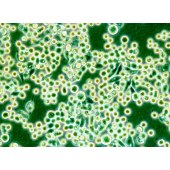 TSINGKE TC‒H0096 KATO III 人胃癌细胞