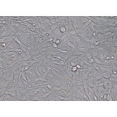 TSINGKE TC‒H0143 ES-2 人卵巢透明细胞癌细胞