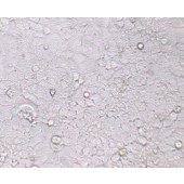 TSINGKE TC‒H0007 MHCC-LM3 人高转移潜能肝癌细胞