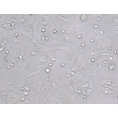 TSINGKE TC‒H0047 NCI-H1703 人肺鳞癌细胞