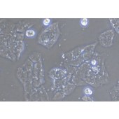 TSINGKE TC‒H0260 A-673 人横纹肌肉瘤细胞