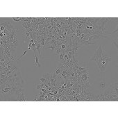 TSINGKE TC‒H0149 BeWo 人胎盘绒膜癌细胞