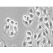 TSINGKE TC‒H0081 BT-20 人乳腺癌细胞