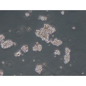 TSINGKE TC‒H0198 LP-1 人多发性骨髓瘤细胞