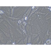 TSINGKE TC‒H0203 U-251 MG 人神经胶质细胞瘤细胞
