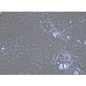 TSINGKE TC‒H0010 PLC/PRF/5 人肝癌亚力山大细胞