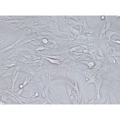 TSINGKE TC‒H0208 SW1783 人脑星形胶质细胞瘤细胞