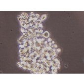 TSINGKE TC‒H0198 LP-1 人多发性骨髓瘤细胞