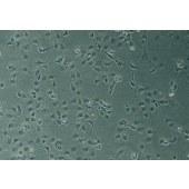 TSINGKE TC‒H0306 HLEC-SRA01/04 人晶状体上皮细胞