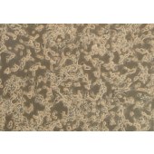 TSINGKE TC‒R0028 CT26.WT 小鼠结肠癌细胞