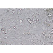 TSINGKE TC‒H0036 NCI-H1395 人肺腺癌细胞