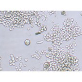 TSINGKE TC‒H0111 COLO 320DM 人结直肠腺癌细胞