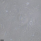 TSINGKE TC‒H0018 RBE 人胆管细胞型肝癌细胞